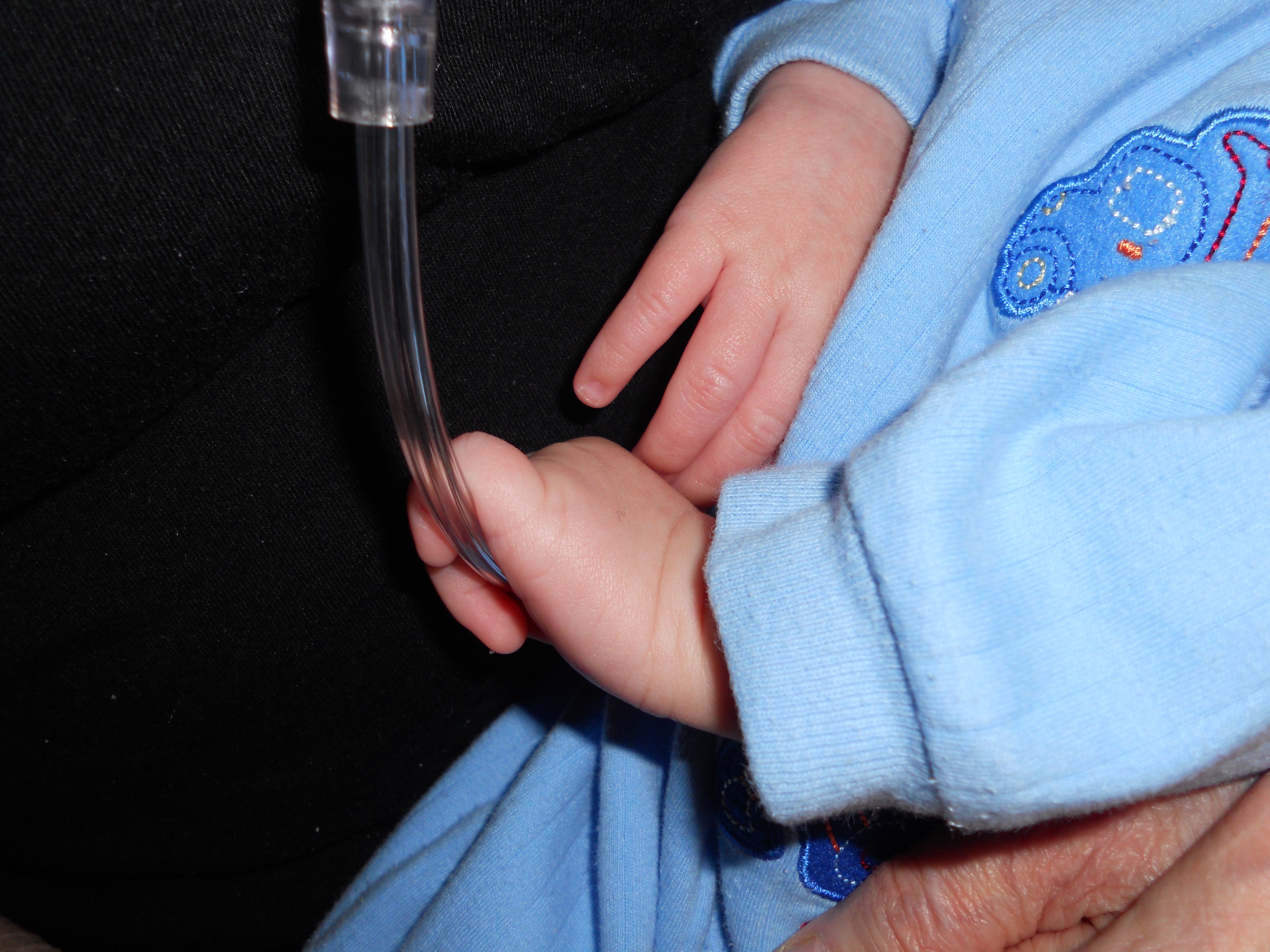 My son gripping the oxygen line like a security blanket