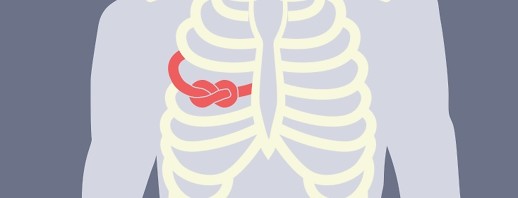 Community Feedback: Rib Cramping with COPD image
