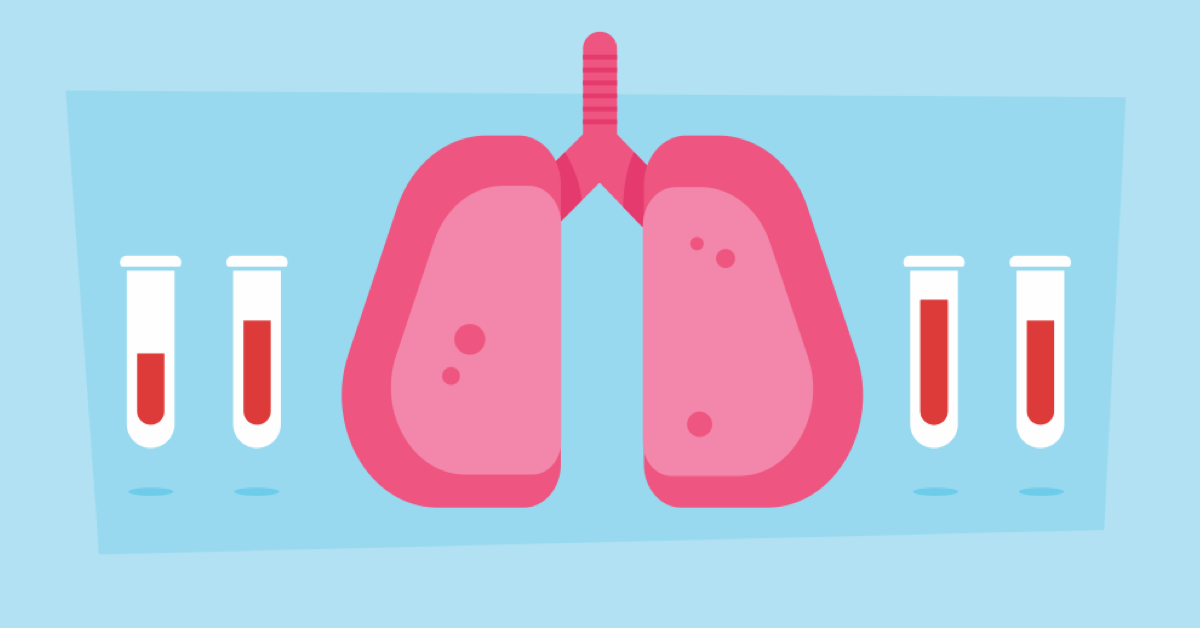 What Happens If You Are Denied a Lung Transplant image