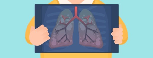 Explaining Emphysema - Part 1: Risk Factors & Symptoms image