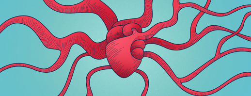 Cardiovascular Conditions Linked to COPD image