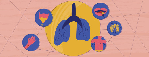 Community Feedback: Strange Symptoms of COPD image