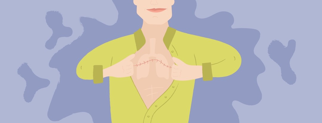 a man pulling open his shirt to show his scar from a lung transplant