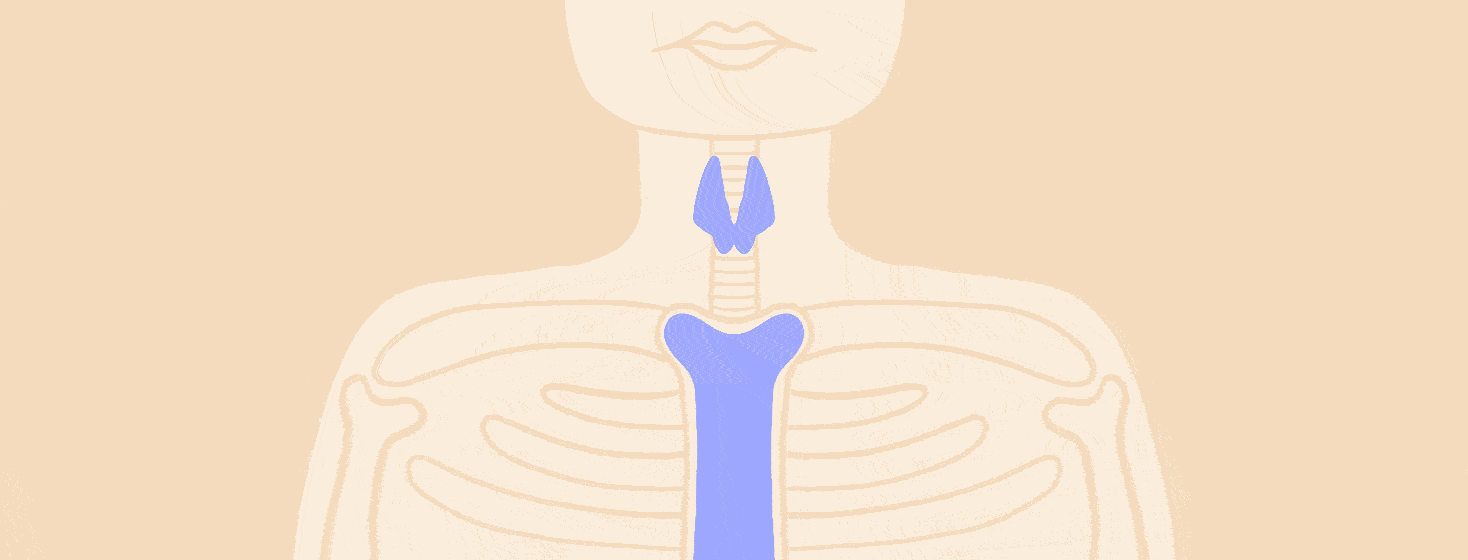 Hypercalcemia and Hyperparathyroidism, a person's neck and shoulders, thyroid and bone are overflowing