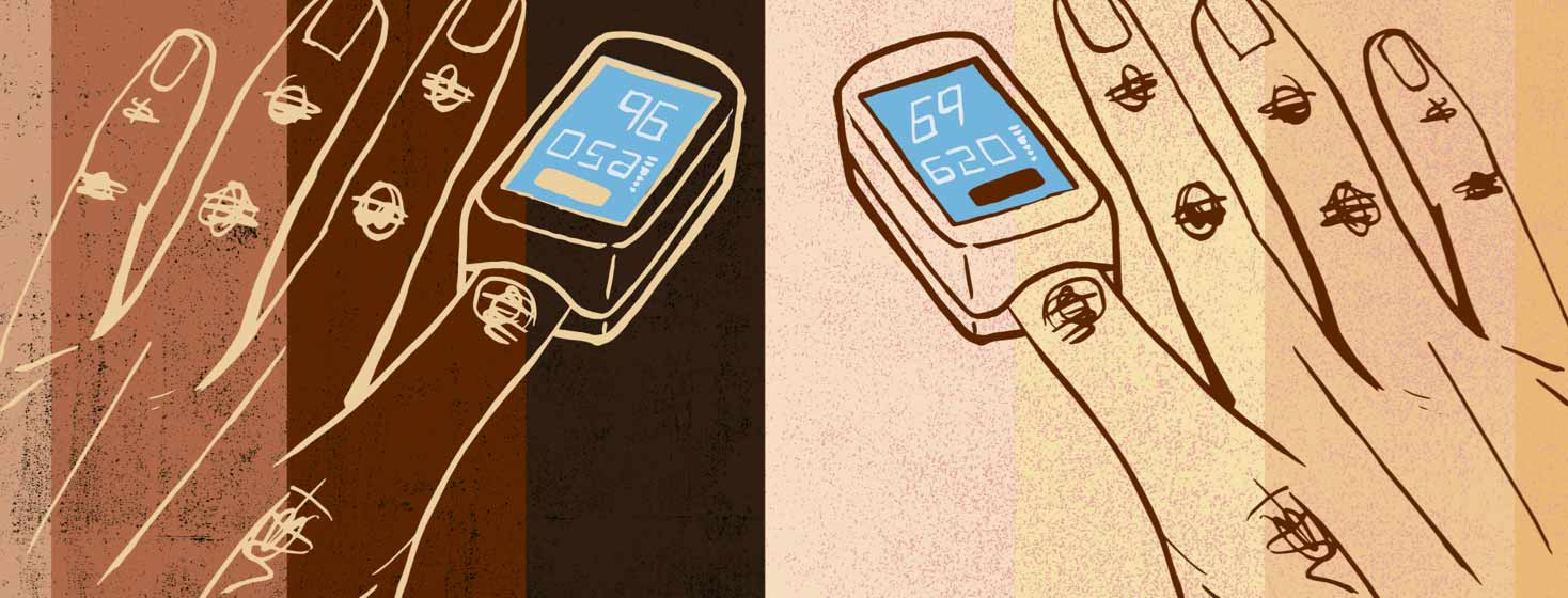 hands with fingers in a pulse oximeter. The background shows a range of skin tones.